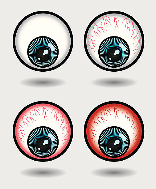 Dry itchy eyeballs - Illustration vectorielle