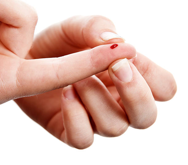 Pazienti diabetici goccia di sangue sul dito - foto stock