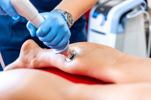 istock Physical therapy of the shin with shock wave, extracorporeal shockwave therapy. 1658827404