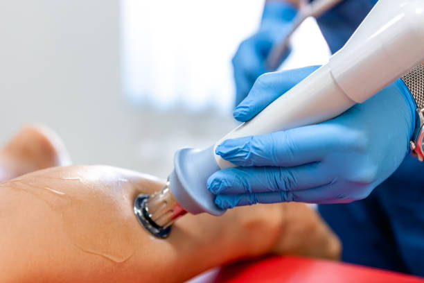 istock Physical therapy of the shin with shock wave, extracorporeal shockwave therapy. 1658827408