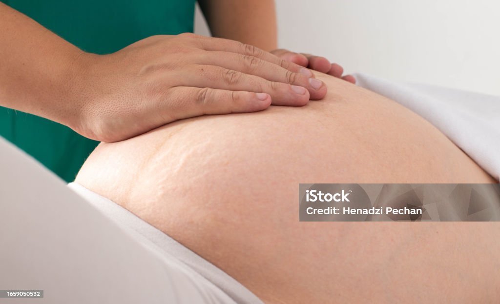 Doctor masseur chiropractor makes a light massage to a pregnant girl for skin tone and removal of stretch marks on the skin. Therapeutic and cosmetic procedure, close-up Doctor masseur chiropractor makes a light massage to a pregnant girl for skin tone and removal of stretch marks on the skin. Therapeutic and cosmetic procedure Healthcare And Medicine Stock Photo