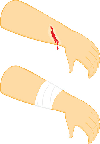 An illustration of an injury and a bandage