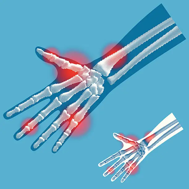 Vector illustration of Hand - X-ray Front View