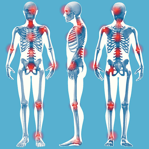 ilustrações de stock, clip art, desenhos animados e ícones de figura pé-frontal, lateral e vista traseira (linework) - pain rib cage x ray image chest