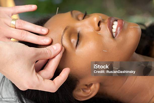 Chinês Agulha O Tratamento Com Outro Medicamento - Fotografias de stock e mais imagens de Acupuntura - Acupuntura, Face Humana, Mulheres