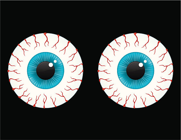 Ojos Irritados Vectores Libres de Derechos - iStock Ojos Irritados Vectores Libres de Derechos - iStock
