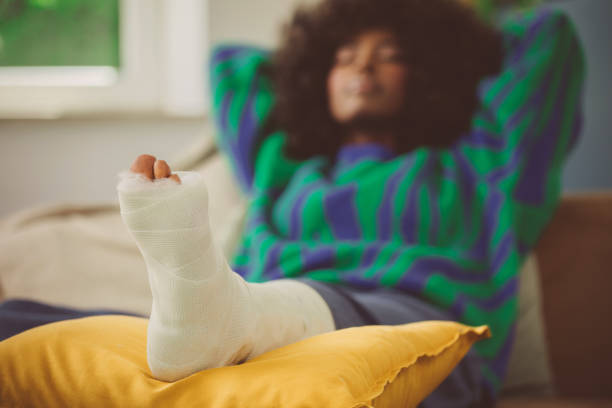 istock Young woman with broken leg resting at home 1661022077