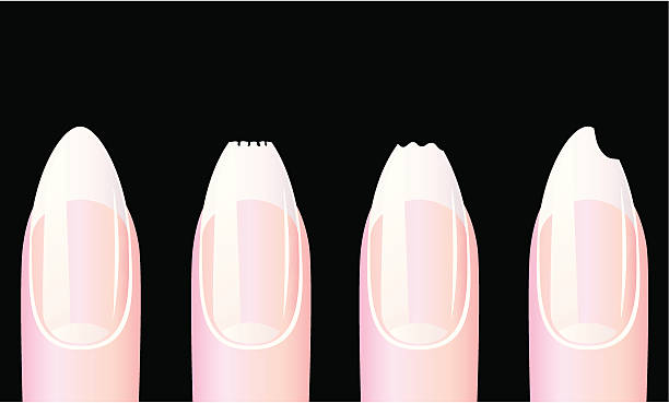 573 Broken Nails Illustrations & Clip Art - iStock | Fingernails, Nail polish, Styrofoam food container 573 Broken Nails Illustrations & Clip Art - iStock | Fingernails, Nail polish, Styrofoam food container