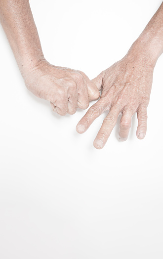 Fingers of elderly people with symptoms of muscle and joint problems, bone marrow