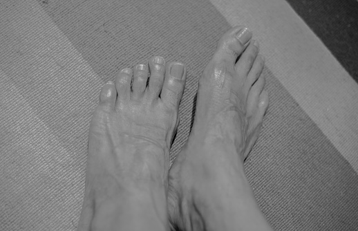 Bare feet of a person with skin wrinkles