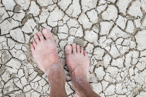 the foot of the senior standing On a dry cracked ground, according to the natural environment