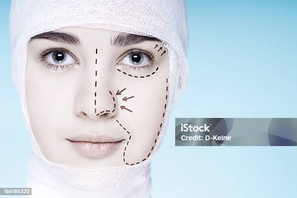 Пластическая Хирургия — стоковые фотографии и другие картинки Лицо человека - Лицо человека, Операция, Подготовка