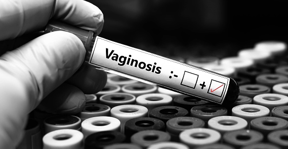 Blood sample of patient positive tested for vaginosis.