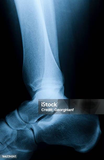 Menschlicher Fuß Stockfoto und mehr Bilder von Röntgenbild - Röntgenbild, Menschlicher Körper, Seitenansicht