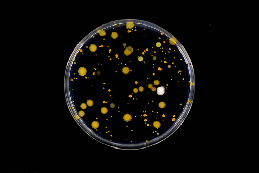 Bacterial colonies emerged on agar plate