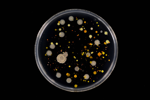 Bacterial colonies emerged on agar plate