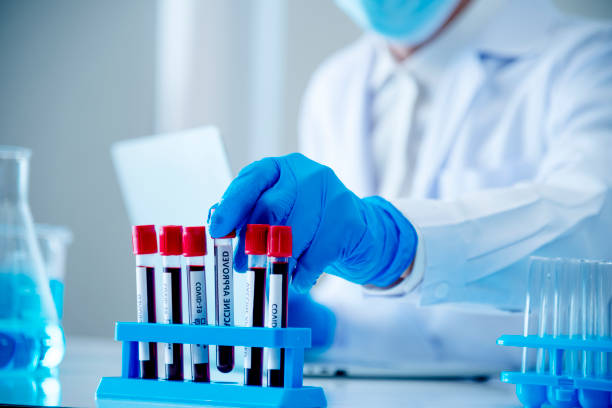 homem cientista segurando amostra de tubo de ensaio de sangue em laboratório de ciências. médico, clínico, técnico de saúde, laboratório de teste de diagnóstico de amostras de sangue. homem asiático cientista que trabalha em laboratório médico d - microscope medical exam healthcare and medicine science - fotografias e filmes do acervo