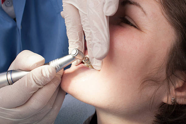 istock Dental Cleaning Close-up 166416475