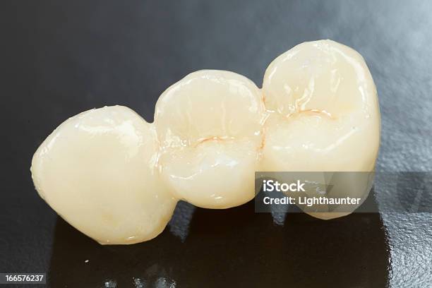 Naciśnięty Ceramiczne Zębów - zdjęcia stockowe i więcej obrazów Czarne tło - Czarne tło, Dentysta, Fotografika