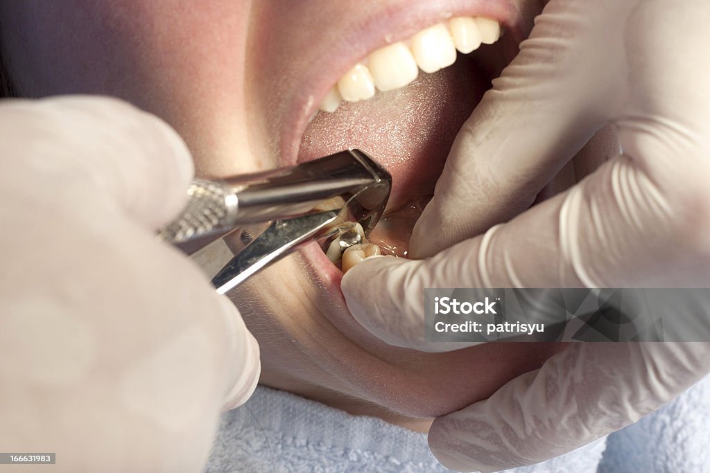 Dentista - Royalty-free Remover Foto de stock