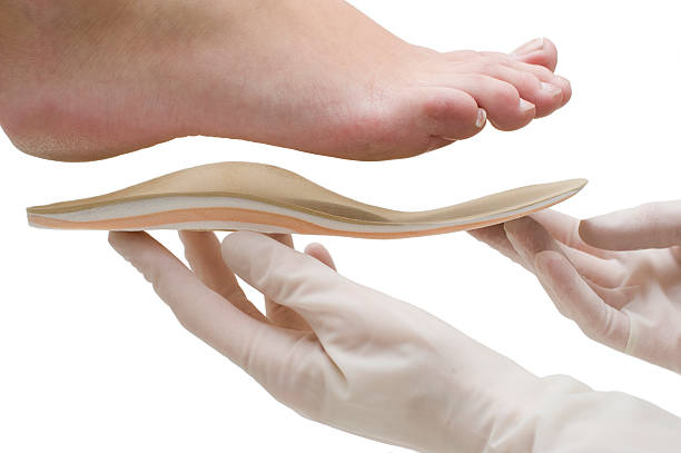 médico s'adapta plantilla de montaje para pie - insoles orthotic human foot podiatry fotografías e imágenes de stock