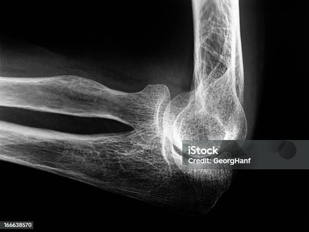 Human Ellenbogen Bone Stockfoto und mehr Bilder von Röntgenbild - Röntgenbild, Ellenbogen, Elle - Armknochen