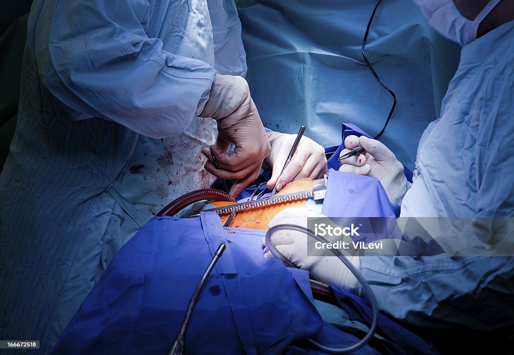 Médicos em operação no paciente - Foto de stock de Aorta royalty-free