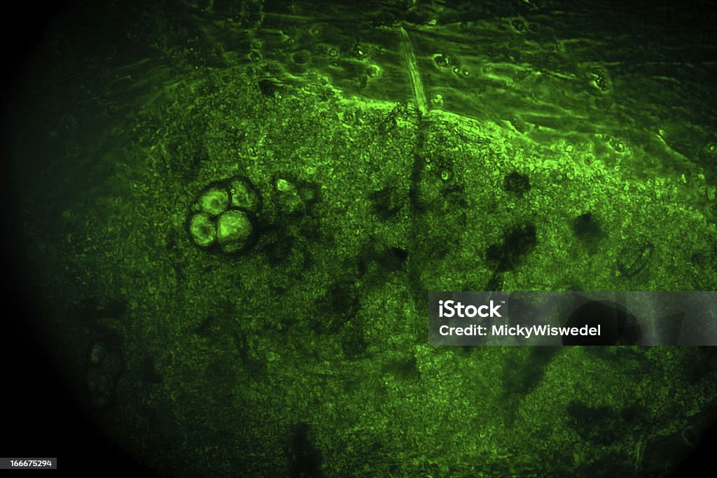 Micrscope お肌の文化 - 人の肌のロイヤリティフリーストックフォト