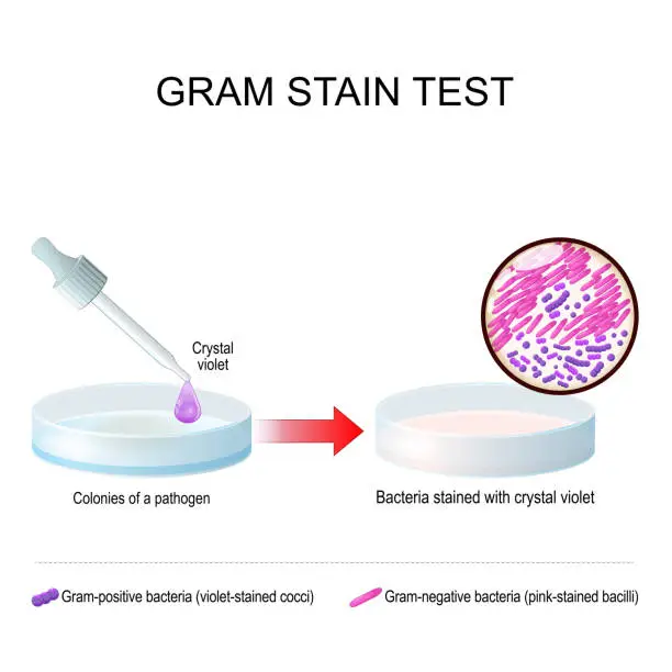 Vector illustration of Gram stain test. A glass Petri dish with pathogen bacterial culture