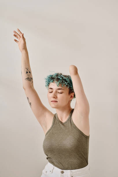 istock Young woman with amputee arm 1667296346