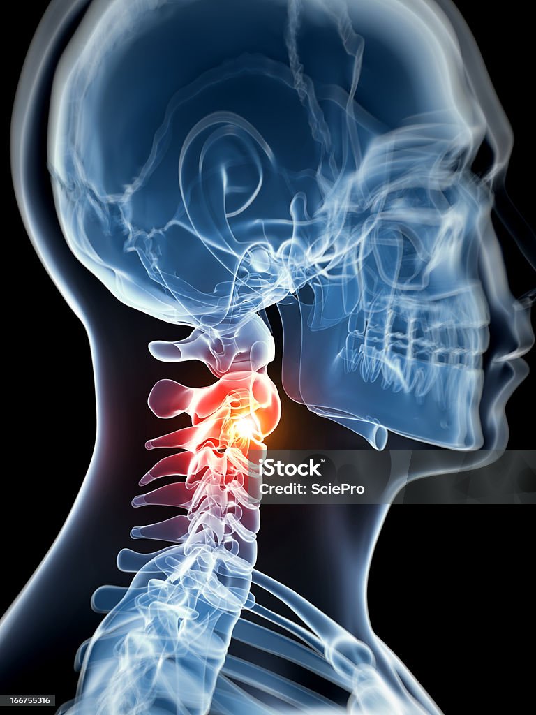 Mal de cou - Photo de Anatomie libre de droits