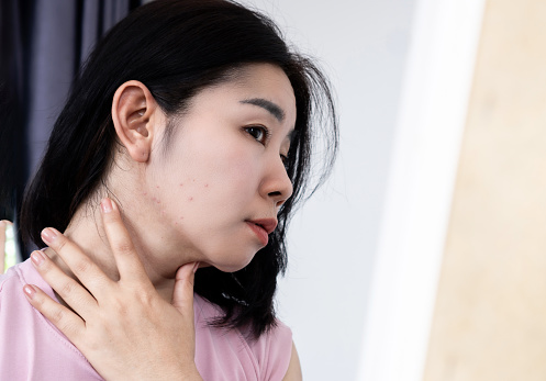 Asian woman have problem with  acne along the jawline checking her face in a mirror
