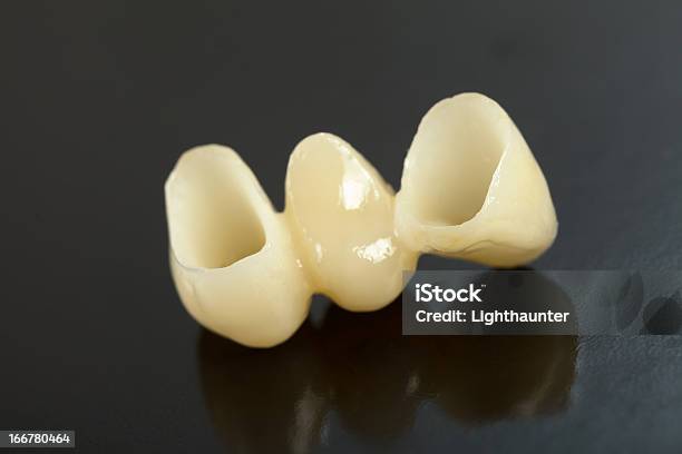 Foto de Pressionado Cerâmica Dentes e mais fotos de stock de Cerâmica - Artesanato - Cerâmica - Artesanato, Consultório Dentário, Coroa dentária