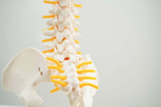 istock Spinal nerve and bone, Lumbar spine displaced herniated disc fragment, Model for treatment medical in the orthopedic department. 1667874606