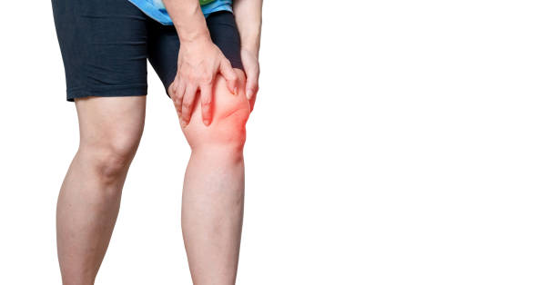 istock bones, osteoarthritis Knee inflammation, knee arthritis disease 1669293048