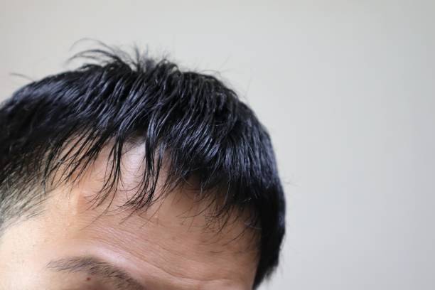 istock Close-up of a thin haired man 1670011416