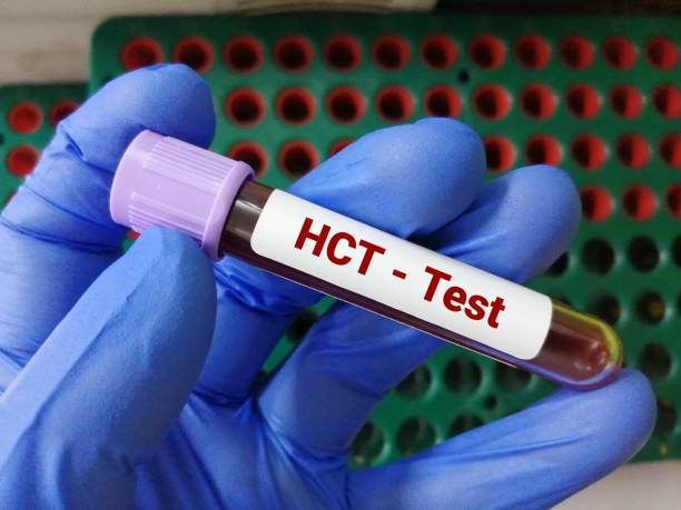 próbka krwi do badania hematokrytu (hct) lub objętości komórek pakowych (pcv). - blood sample blood tube pathologist zdjęcia i obrazy z banku zdjęć