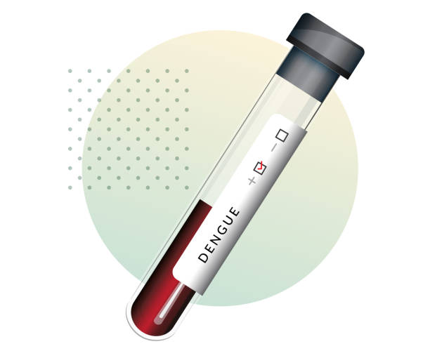 Blood Sample Taken for Dengue Test - Stock Illustration Blood Sample Taken for Dengue Test - Stock Illustration as EPS 10 File malaria blood sample stock illustrations