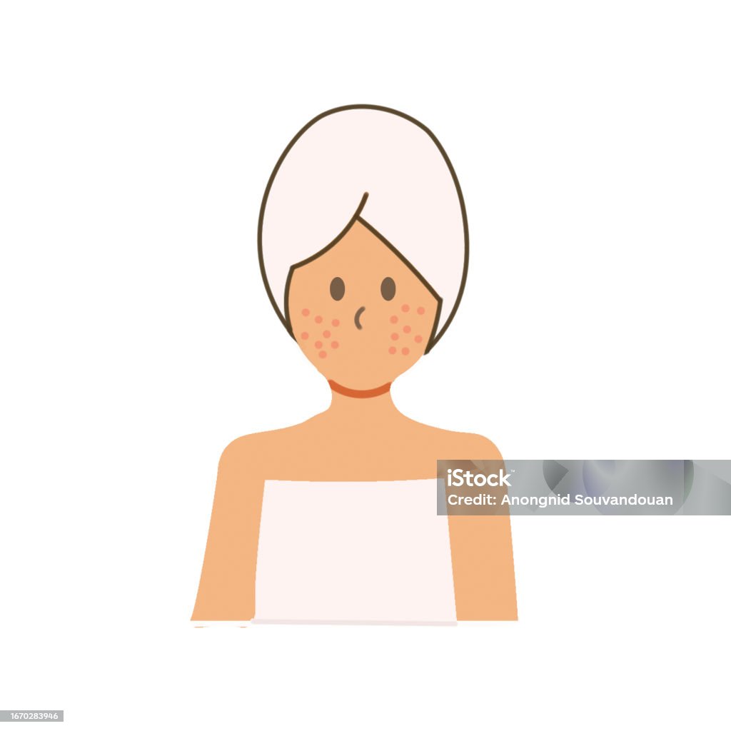 Acne Scratch Acne Vector Stock Illustration - Download Image Now - Blob, Freckle ...