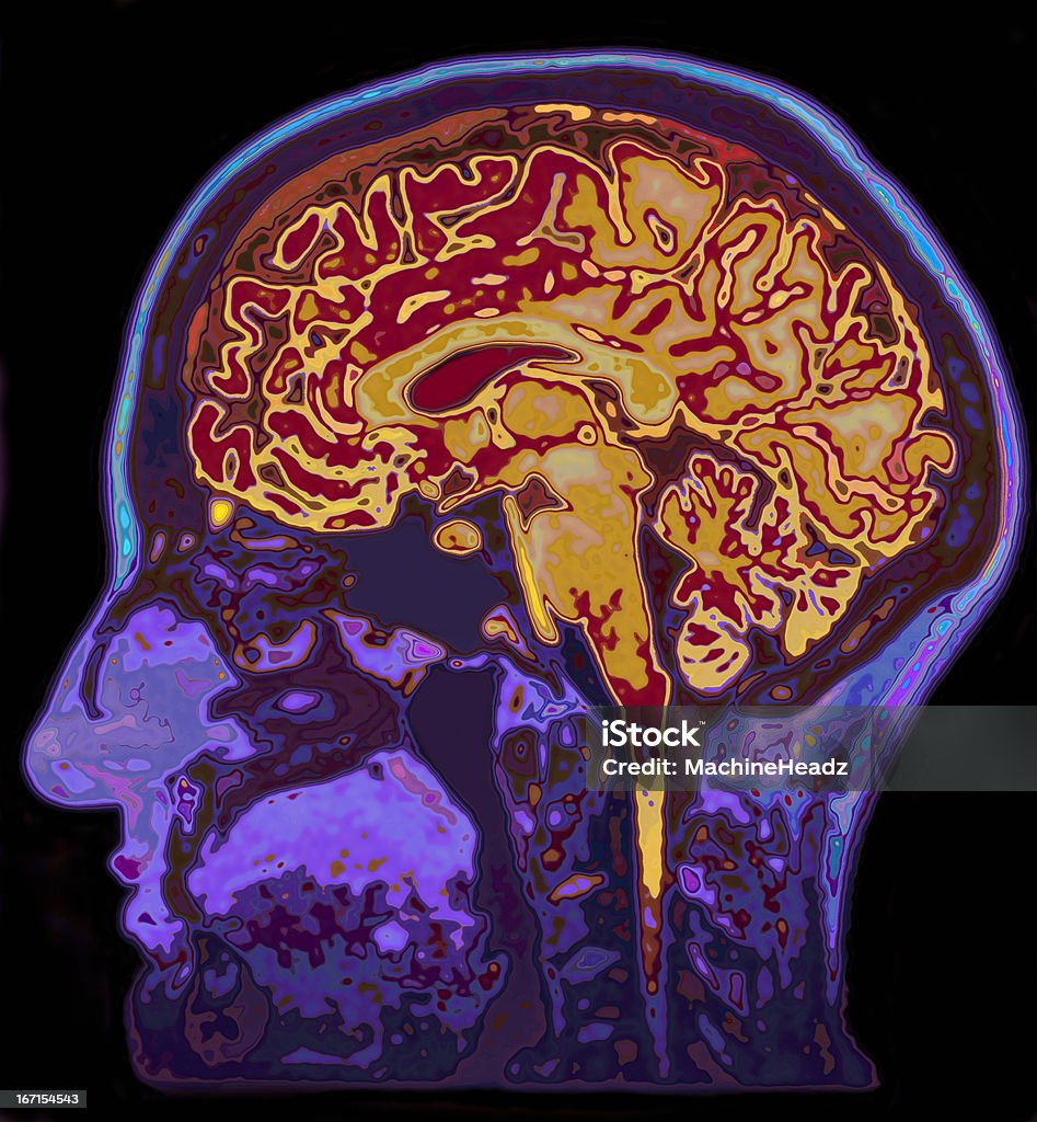 MRI Image Of Head Showing Brain The mind as a powerful tool MRI Scan Stock Photo