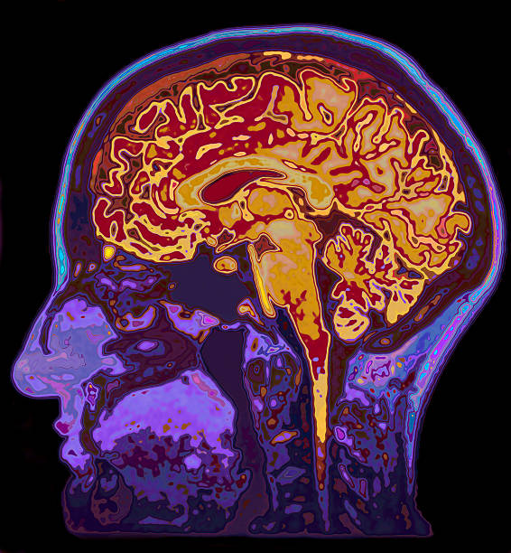 mri imagem de cabeça com cérebro - exame de ressonância magnética - fotografias e filmes do acervo