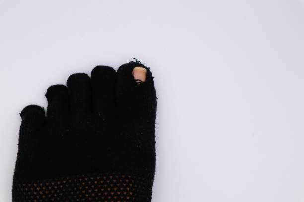 istock Close-up of socks with holes 1672024772