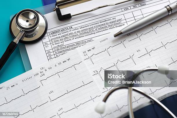 Estetoscopio En El Electrocardiograma Y Foto de stock y más banco de imágenes de Accidentes y desastres - Accidentes y desastres, Afección médica, Analizar