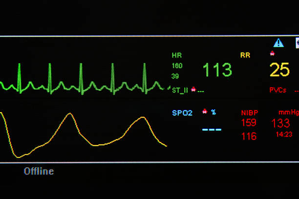 istock EKG monitor in ICU unit 167305537