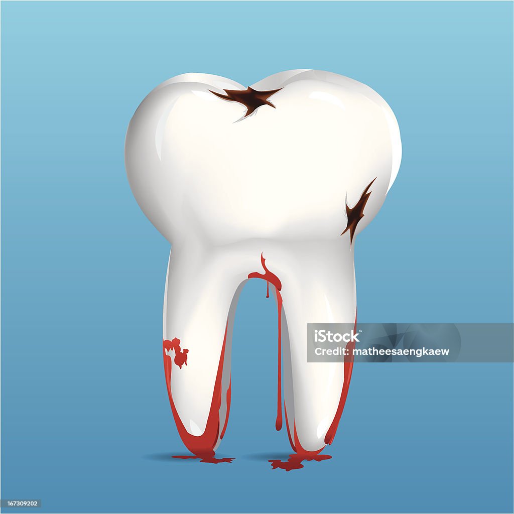 Dientes - arte vectorial de Anatomía libre de derechos