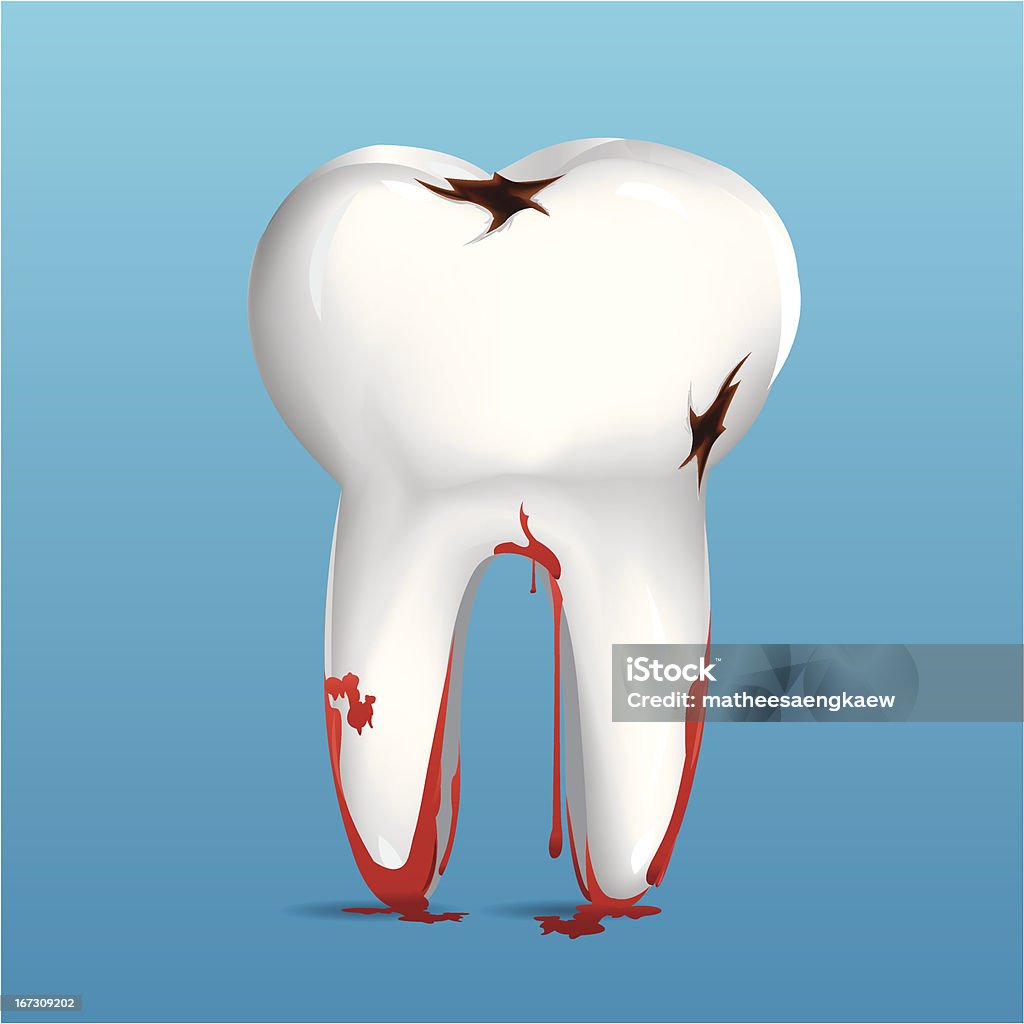 Ząb - Grafika wektorowa royalty-free (Anatomia człowieka)