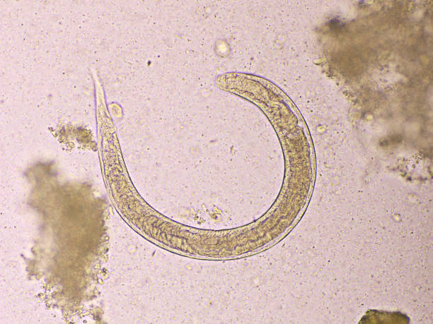 istock Strongyloides stercoralis or threadworm 1674216371