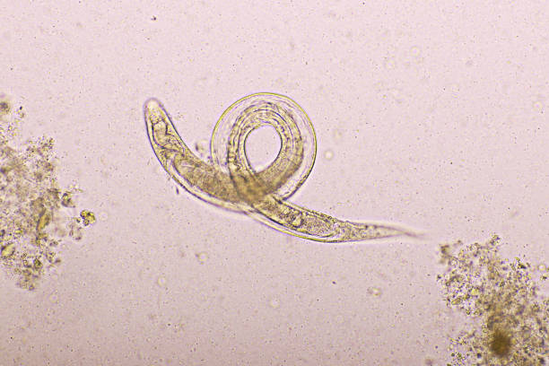 istock Strongyloides stercoralis or threadworm 1674216374