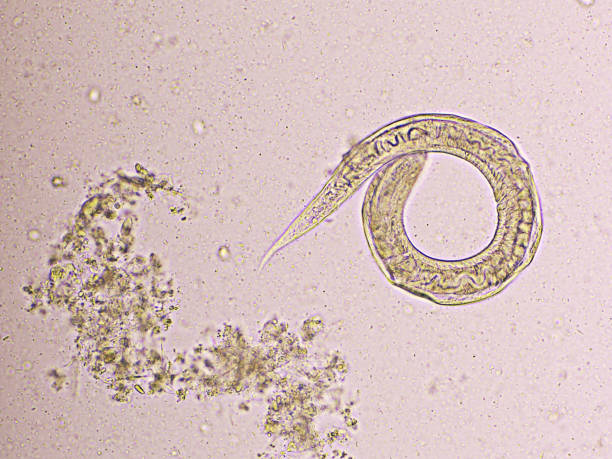 istock Strongyloides stercoralis or threadworm 1674216375