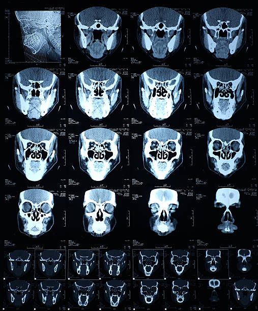 testa radiografia - mri scan cat scan machine x ray brain foto e immagini stock